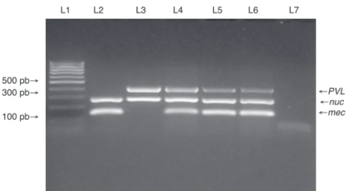 Fig. 1 – Multiplex PCR for detection of nuc, mecA, and PVL genes. Multiplex PCR was performed to detect the presence of nuc, mecA and PVL genes in isolates from medical students to confirm Staphylococcus aureus species (nuc gene), methicillin resistance (m