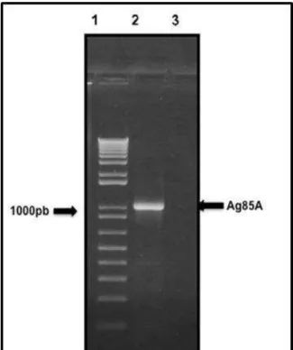 Figure  11:  Análise  do  produto  de  amplificação  por  PCR  da  ORF  Ag85A  de  M. 