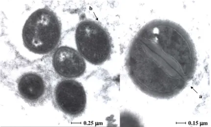 Figure  4.  The  ultrastructure  of  MRSA  4  hours  after  it  has  been  phagocytosed  by  the human macrophage that had been subsequently exposed to a concentration of  TZ  of  0.1  mg/L