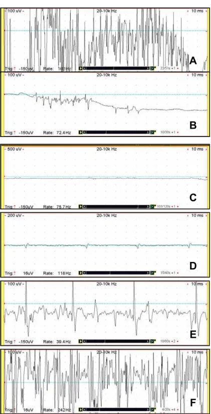 Figura 3. Exemplos de traçados eletromiográficos de musculatura estriada  esquelética de cães