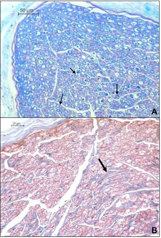 Figura 11. Fotomicrografias de nervos de cães com leishmaniose visceral (A)  corte transversal, fibras nervosas mielinizadas, notar a variação no  diâmetro das fibras nervosas (setas) – Luxol Fast Blue 20x; (B)  Aumento de tecido conjuntivo no endoneuro (s