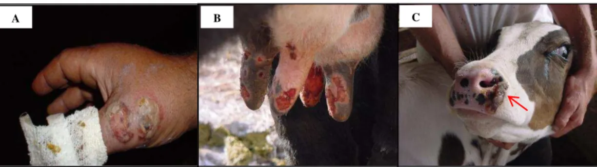 Figura 3 Lesões observadas na VB. (A) Lesões na mão de um ordenhador. (B) Lesões ulcerativas nos tetos  de  uma  vaca  em  lactação