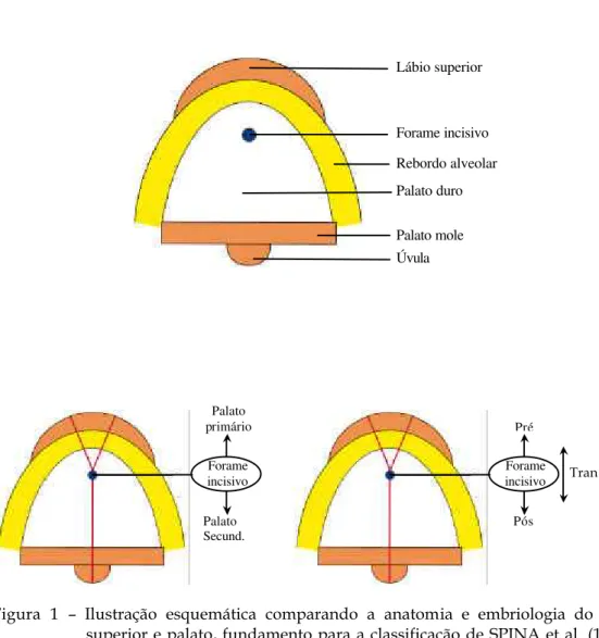 Figura 1  – Ilustração esquemática comparando a anatomia e embriologia do lábio  superior e palato, fundamento para a classificação de SPINA et al