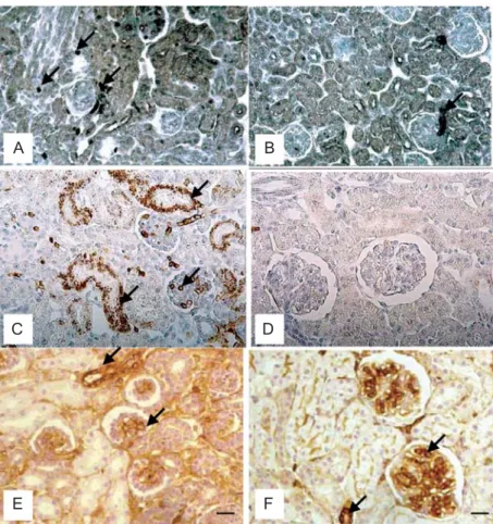 Figure 1. Immunolocalization of angiotensin II (A and B), phospho-extracellular signal- signal-regulated protein kinase (p-ERK; C and D), phospho-c-jun N-terminal kinase (p-JNK; E and F) (arrows) in the renal cortex of rats at 1 (A, C, and E) and 30 days (