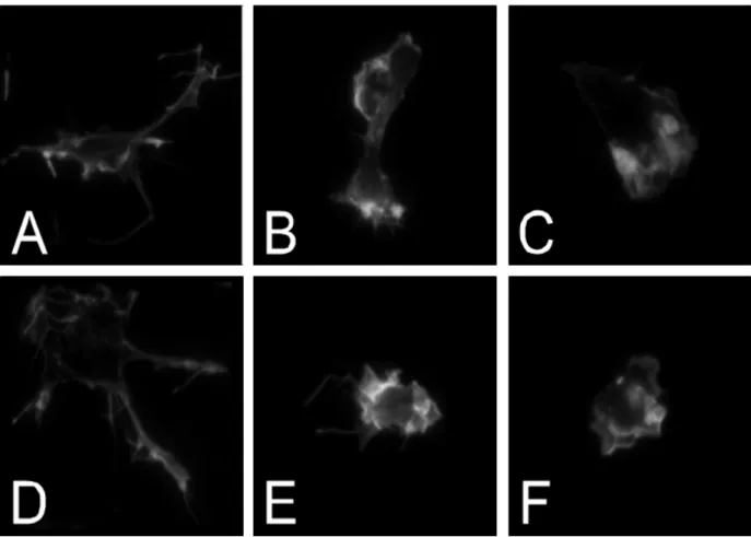 Figure 1.1: Microglial cells in distinct states. A, D: Resting microglial cell; B,E: Transition microglial cell; C, F: Active microglial cell.