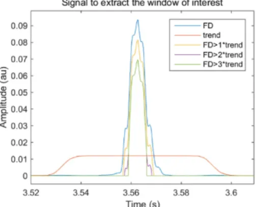 Figure 3. Adaptive threshold applied to the fractal dimension (FD) signal to identify the window of interest of a potential crackle by   ܨܦ ൐ ܺ ൈ ݐݎ݁݊݀, where ܺ ൌ ͳǡ ʹǡ ͵