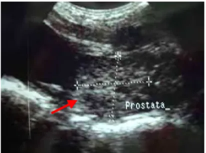 Figura 7 –   Imagem ultra-sonográfica da próstata normal  de cão (seta vermelha), via transabdominal,  obtida com transdutor setorial de 5 MHz