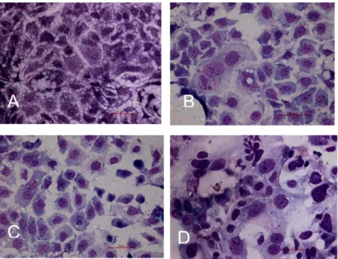 Figure 6. Effect of hyperoxia on Caco-2 cell survival. On the 3rd  day, cells rapidly died in the presence of 90% O 2  (*P < 0.01,  t-test) and on the 6th day, at 60 and 90% O 2  cell numbers were  rapid decreased compared to 21% O 2  ( + P < 0.01, t