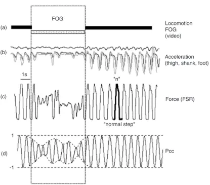 Figure 2. An example of freezing of gait (FOG) detection using Pearson’s cor- cor-relation coefficient (Pcc) analysis
