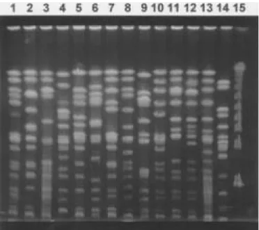 Figure 1. Results of PFGE showing genotypes identified from A to M using the pulse time ramped from 1s to 30s by 24h