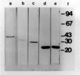 Figure 2. Dot plots of indirect  immunofluorescence activated cell sorter analyses with whole cells (wc) of N.