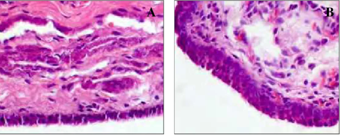 Figura 4 – A- Hiperplasia epitelial leve; B- Hiperplasia epitelial intensa (HE, 40x).