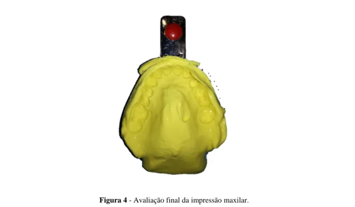 Figura 4 - Avaliação final da impressão maxilar. 