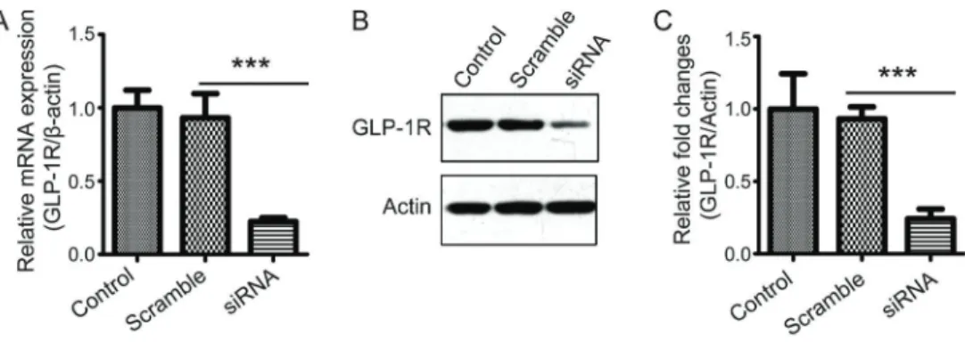 Figure 1. GLP-1R knockdown in macrophages using siRNA. RAW264 cells were transfected with siRNA of GLP-1 receptor (GLP-1R) and scramble siRNA for 72 h