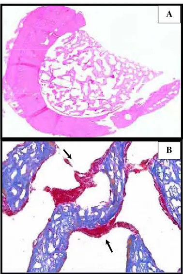 FIGURA 6 - Fotomicrografias do G2 tratado: (A) Área do defeito ósseo, totalmente preenchido  por trabéculas ósseas neoformadas