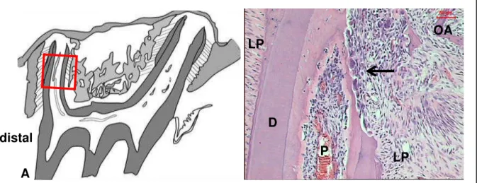 Figura 13 -  A. Área selecionada em vermelho. B. Dentina (D) com reabsorção ativa  e profunda (seta); ligamento periodontal (LP), polpa (P), osso alveolar (OA)