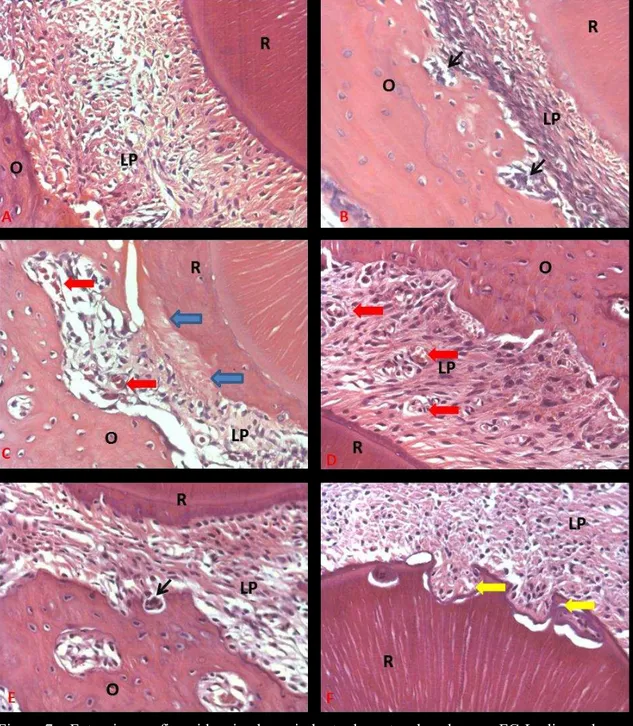 Figura 7 – Fotomicrografia evidenciando periodonto dos ratos do subgrupo FC-L, dispondo na  primeira coluna a região da RMV em 5 (A), 7 (C) e 9 (E) dias e na segunda coluna a região da  RDV em 5 (B), 7 (D) e 9 (F) dias