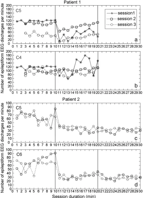 Fig. 4. Number of epileptiform EEG discharges of patient1 and patient 2 per minute measured at electrodes C 5 (a) and C 4 (b) and C 5 (c) and C 6 (d), respectively, before (timepoint 1), during (timepoint 2), and after (timepoint 3) DC stimulation for the 