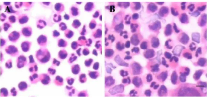 Table 3. Serum high-sensitivity C-reactive protein (hs-CRP) and chemokine levels and chemokine mRNA expression in the stable (SAP) and unstable (UAP) angina pectoris groups of patients.