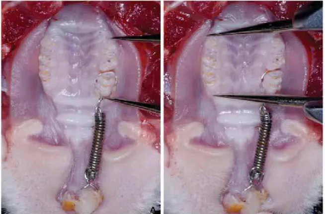 Fig 3.  Medida da quantidade de movimentação dentária obtida pela diferença  entre as distâncias da face mesial do 1º molar superior até a distal do 3º  molar  superior,  do lado direito movimentado (A) e esquerdo não  movimentado (B)