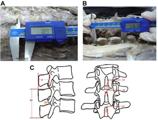 Figure 1. Illustration of measuring method for each parameter. A, Measurement of DB; B, measurement of DA; C, schematic diagram of H, DA, DB, TI, TS, and TC