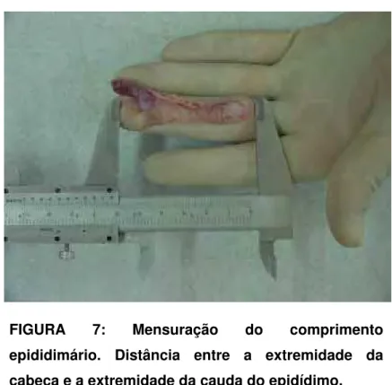 FIGURA 7: Mensuração do comprimento  epididimário. Distância entre a extremidade da  cabeça e a extremidade da cauda do epidídimo