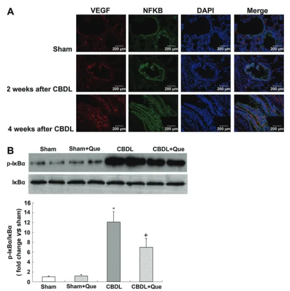 Figure 5. Immuno ﬂ uorescence localization of NF-kB p-65 and VEGF-A after common bile duct ligation (CBDL)