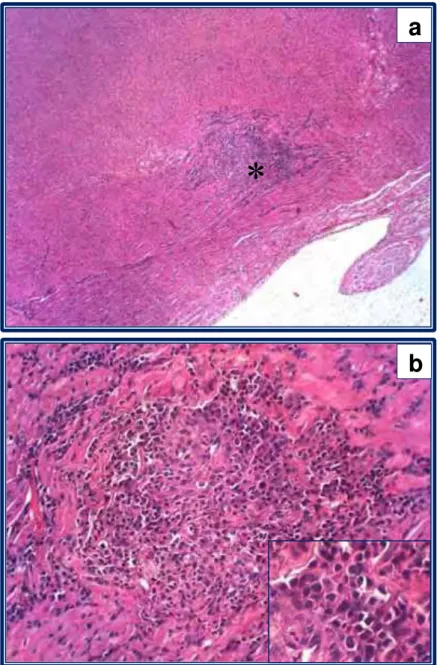 FIGURA 7  -  Fotomicrografias  de  septo  interventricular  de cão naturalmente acometido por LV,  evidenciando a presença de granuloma do  tipo lepromatoso (), nas objetivas de 10x  (a) e 40x (b), com predomínio de linfócitos  e macrófagos (detalhe)
