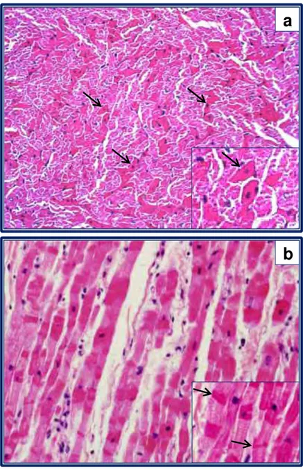 FIGURA 8 -  Fotomicrografias do miocárdio de cães  naturalmente acometidos por LV. (a) Em  ventrículo direito observa-se a ocorrência  de necrose coagulativa de cardiomiócitos  (setas) caracterizada por eosinofilia, perda 