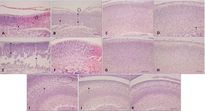 Figure 1. Photomicrographs of histological slides of newborn rat brains. Cerebral cortex: A: preterm asphyxiated rats; B: preterm asphyxiated and ventilated rats; C: preterm control rats; D: preterm ventilated rats; E: term asphyxiated rats; F: term asphyx