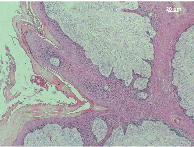 Figura  4.  Sarcoide  equino  do  tipo  clínico  nodular,  obj.  10x.  Epiderme  hiperceratótica  e  hiperplásica,  com  formação  de  “rete  ridges”