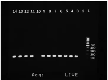 Fig. 1 - Agarose gel electrophoresis of PCR assays for   the identification of (a) IS6110 gene