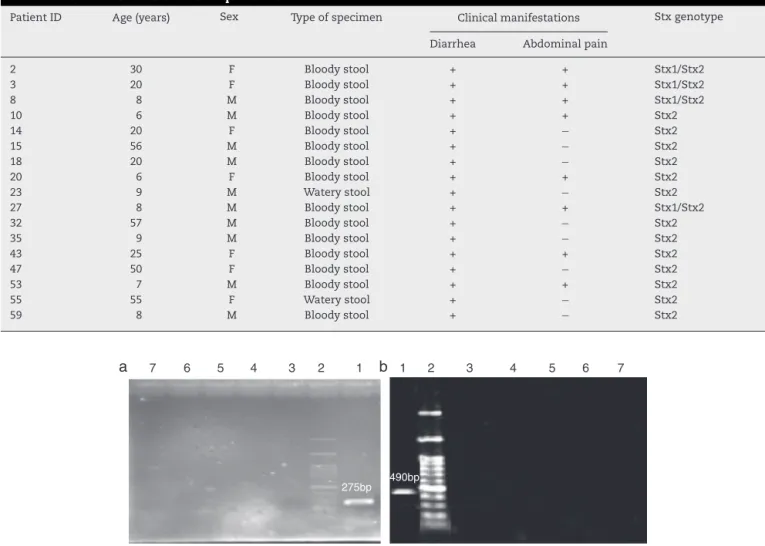 Fig. 2 – Specificity of PCR detection of E. coli O157:H7 (a) and Shigella dysenteriae (b)