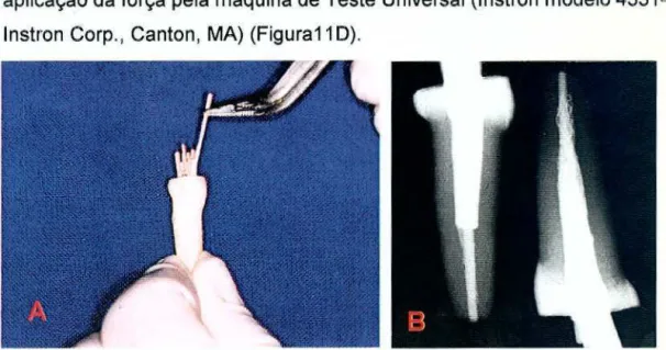 FIGURA 9 -A) Obturação endodôntica; B) Verificação radiográfica da qualidade  da obturação