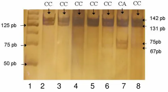 Figura 4 - Gel de poliacrilamida a 10% referente aos produtos da digestão do PCR do  gene P21/WAF1