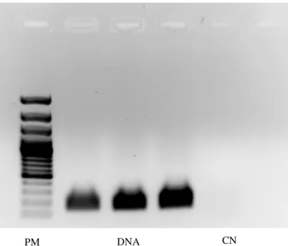 Figura 9 - Produto de PCR amplificado (163 bp), relativo à bactéria P. intermedia. 10  µl de volume de reacção