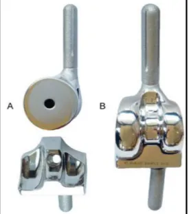 Figura  5  –  PTC  Iowa  atual:  A)  Vista  sagital  da  prótese,  exemplificando  a  articulação  dos  componentes  em  extensão  máxima