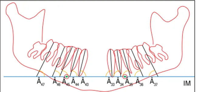 FIGURA 5 - Radiografia panorâmica do Grupo II (com a presença dos  terceiros molares inferiores) com traçado que delimita suas estruturas  dentoesqueléticas, pontos FM d  e FM e , linha intermentoniana (IM),  lon-gos  eixos  dentários  e  ângulos  formados