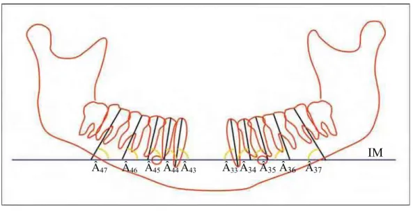 FIGURA 13 - Traçado da linha intermentoniana (IM) e dos longos eixos  dentários do Grupo II (com a presença dos terceiros molares  inferiores)