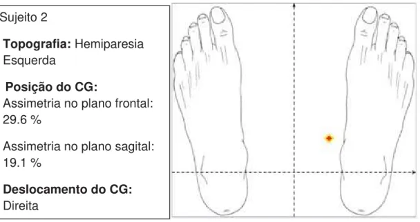 Figura 3: Resultados da avaliação – dados topográficos e projeção do centro de  gravidade do Paciente 2