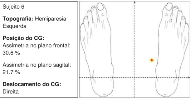 Figura 7: Resultados da avaliação – dados topográficos e projeção do centro de  gravidade do Paciente 6