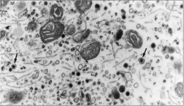 Fig. 2 — Portion of the cytoplasm of mouse pinealocyte, treated with melatonin, showing dense-core vesicles (arrows)