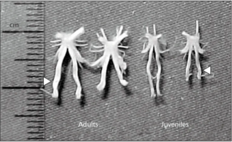 Fig. 1 — Brains removed from Farfantepenaeus paulensis adults and juveniles. Only the circunoesophageal commissure (arrowheads) was kept to facilitate handling and vertical orientation in the paraffin wax.