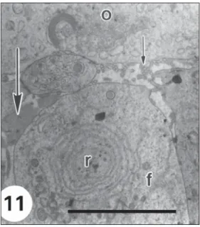 Fig. 11 — High magnification of an area of Fig. 10 showing patches of zona pellucida (big arrow) and microvilli (arrow), between the oocyte (o) and the follicular cells (f) and concentric rings of REG (r) in the follicular cells