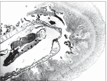 Fig. 2 — Histopathological analysis showing Neoechinorhynchus curemai in the intestinal lumen of Prochilodus lineatus.