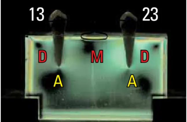 Figure  10  shows  that  in  the  absence  of  a  T-spring  no  photoelastic  fringes  are  formed