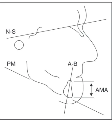 TABELA 1 - Análise de variância da AMA (altura mandi- mandi-bular anterior). Fonte de variação g.l