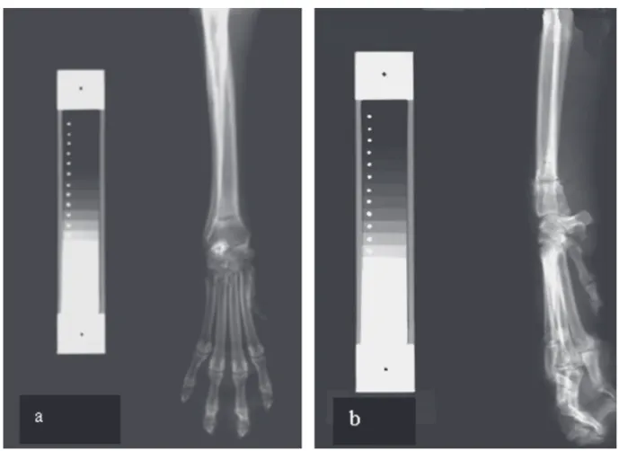 Figura 1 -  Imagem radiográfica de fratura na extremidade distal do rádio em projeções (a) crânio-caudal e (b) médio-lateral do membro torácico                      direito, grupo do tratado aos 15 dias pós-operatório