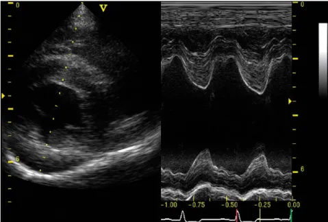 Figura  11  –  Ecocardiografia  em  Modo  M  obtido  ao  nível  dos  músculos  papilares  do  VE  de  uma  CKCS