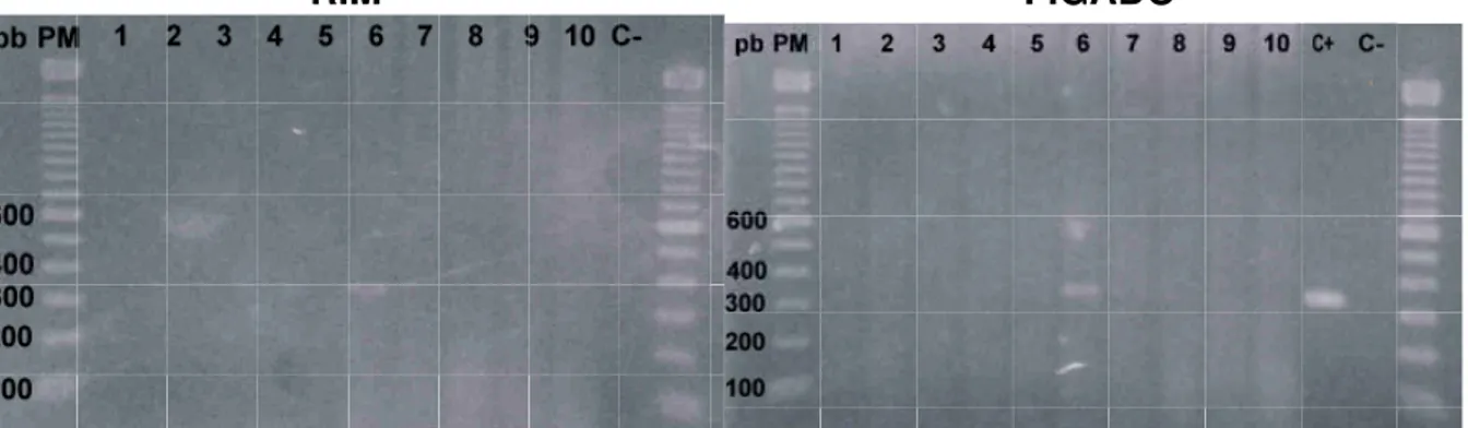 Figura 1 – Gel de agarose a 2%. Visualização de banda de 331pb, amplificado de segmento  de DNA de leptospira, de amostras de rim e fígado contaminadas nas concentrações de  2,0x10 4  (linha 1); 2,0x10 3  (2); 2,0x10 2  (3); 2,0x10 1  (4); e 2,0x10 0  (5) 